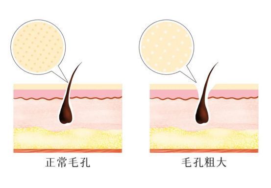 深入剖析毛孔管理：从清洁到保湿的全面指南